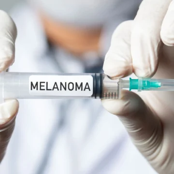 Vacuna melanoma